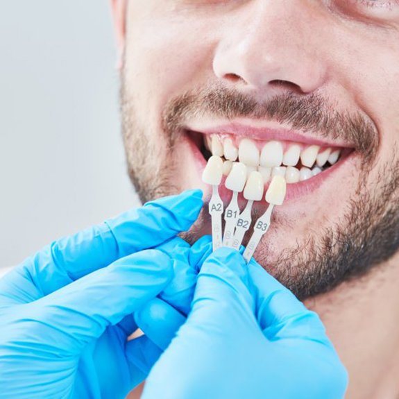 dentist holding several veneers up to a man’s smile 
