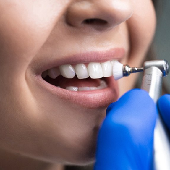 Closeup of patient getting a dental cleaning in Royse City 