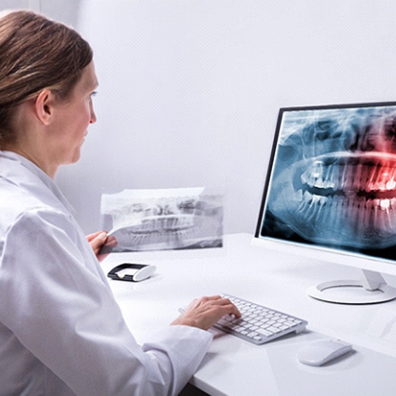 Implant dentist in Royse City examining an X-ray