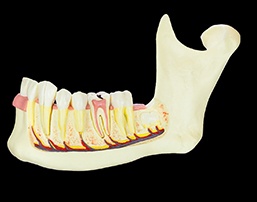 a model of a jawbone and teeth