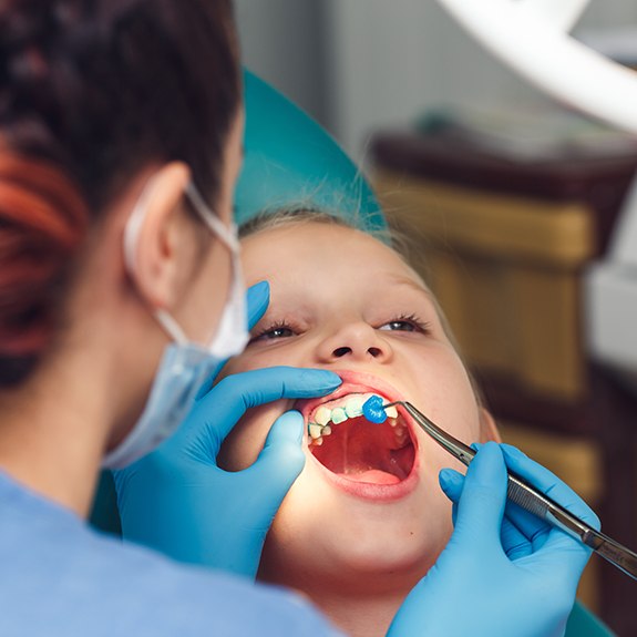 young child getting fluoride treatment 