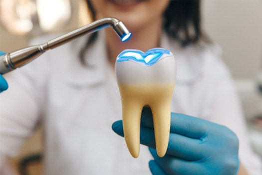 Dentist demonstrating filling on large model tooth
