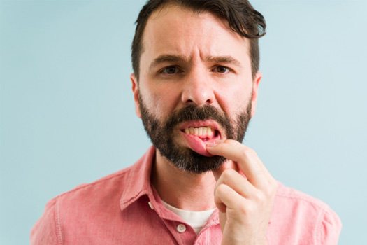 Man in pink shirt pulling down lower lip to reveal darkened gum tissues