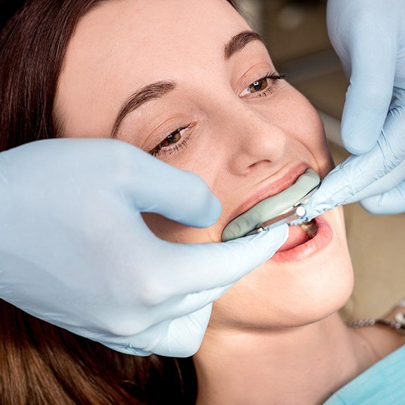 Woman receiving fluoride treatment