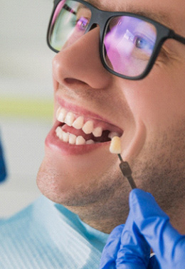 Replace missing teeth near Fate