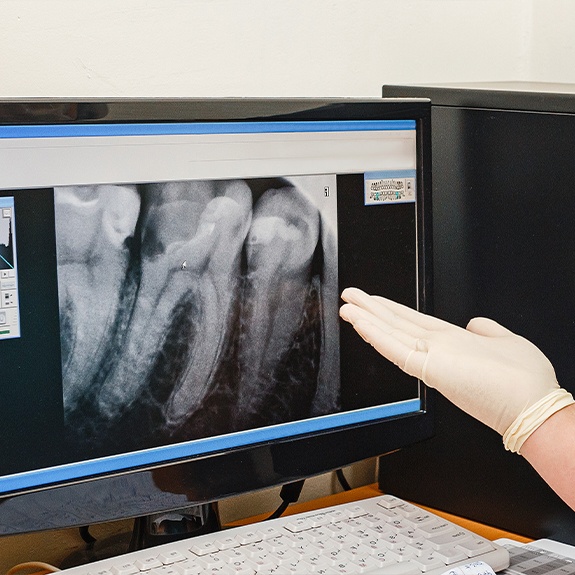 Digital x-rays on computer monitor
