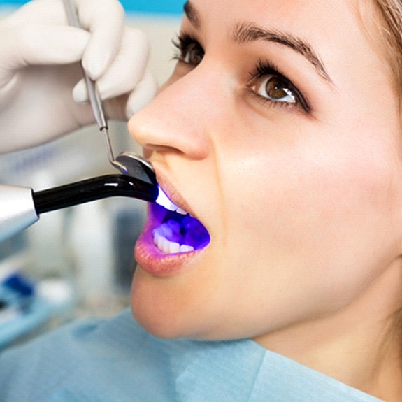 Dentist using curing light on tooth-colored filling