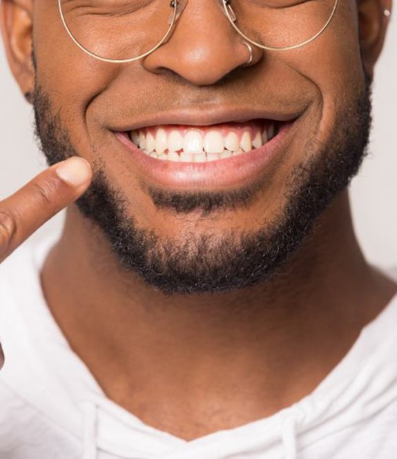 close up of a man pointing to his smile with veneers in Royse City 