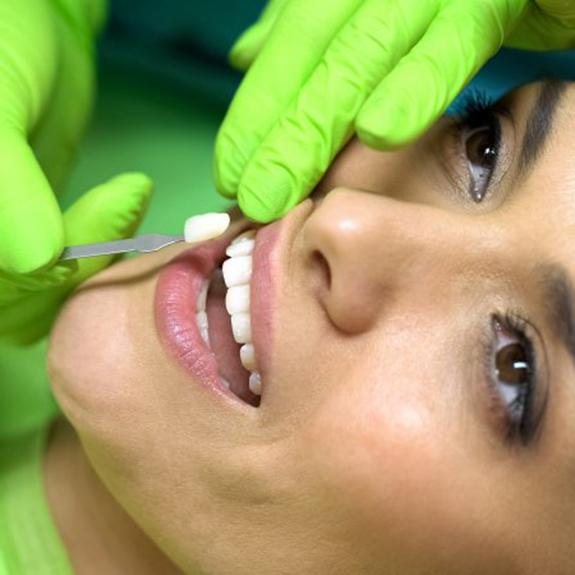 dentist placing a veneer in a woman’s smile 