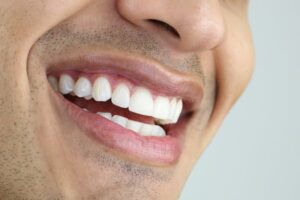Man with white teeth smiling. 